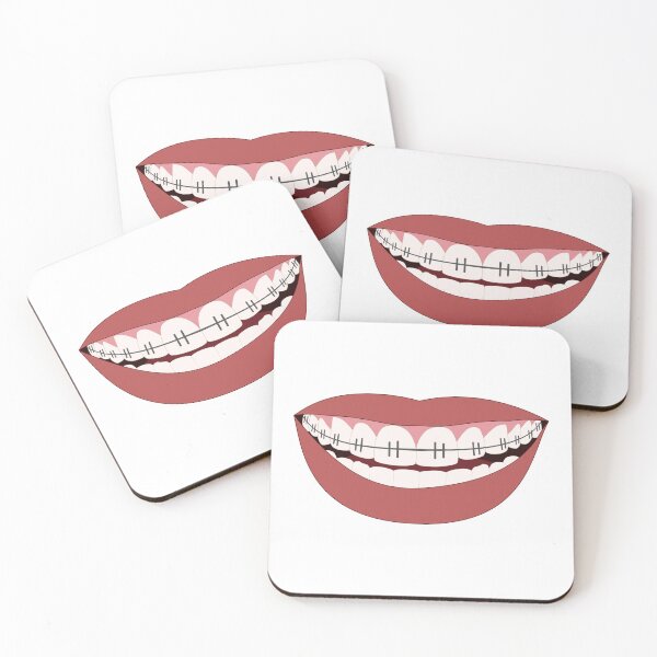 Item preview, Smile with Braces designed and sold by rgsblo.