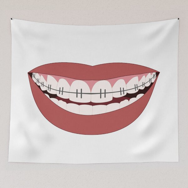 Item preview, Smile with Braces designed and sold by rgsblo.
