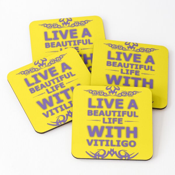 Item preview, Live a beautiful life with vitiligo  designed and sold by karimaK-71.