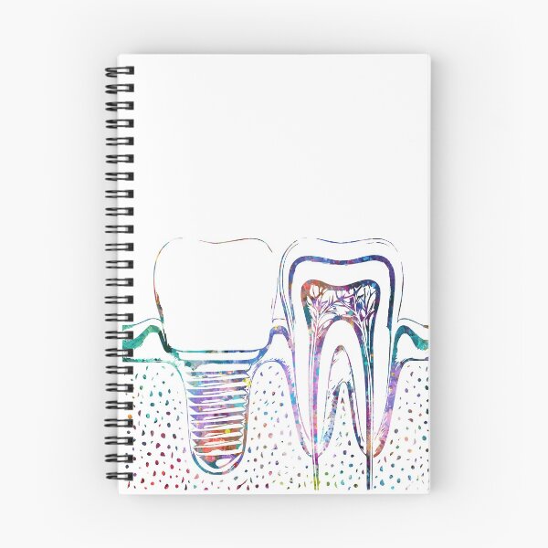 Item preview, Human Tooth with Dental Implant designed and sold by EvasDreams.