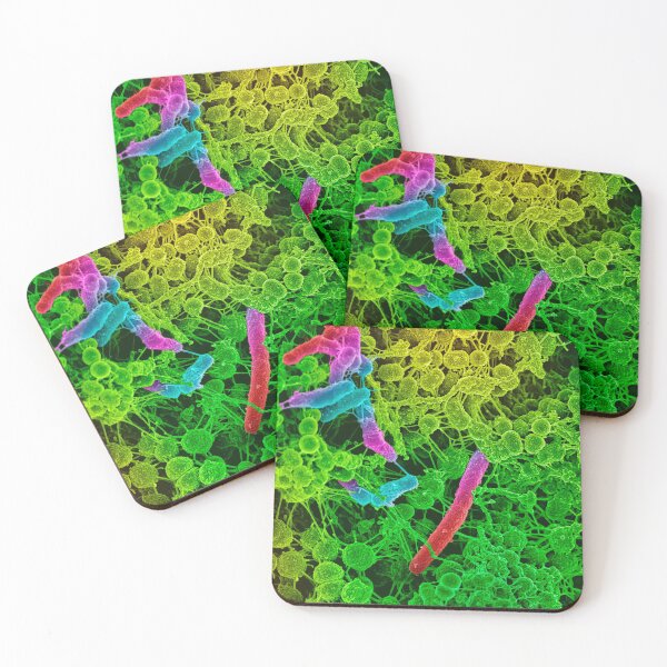 Item preview, COLORED STREP BACTERIA MICROSCOPIC VIEW PHOTO IMAGE MEDICAL LABORATORY SCIENTIST designed and sold by Hippiesole.