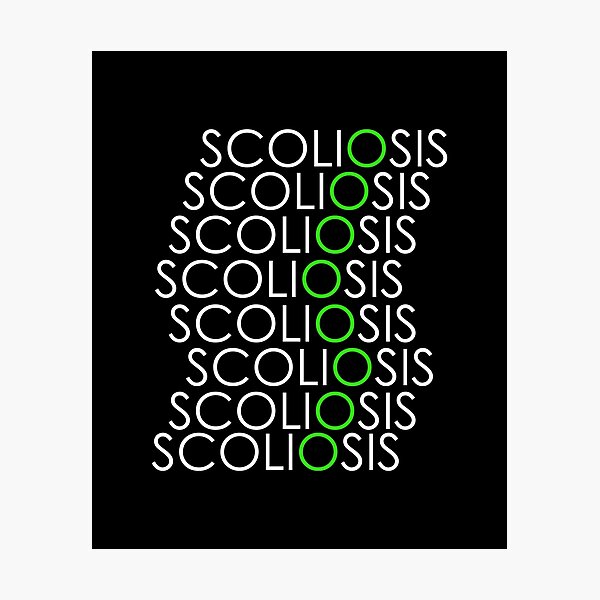 Item preview, Scoliosis designed and sold by mederDESIGNS.