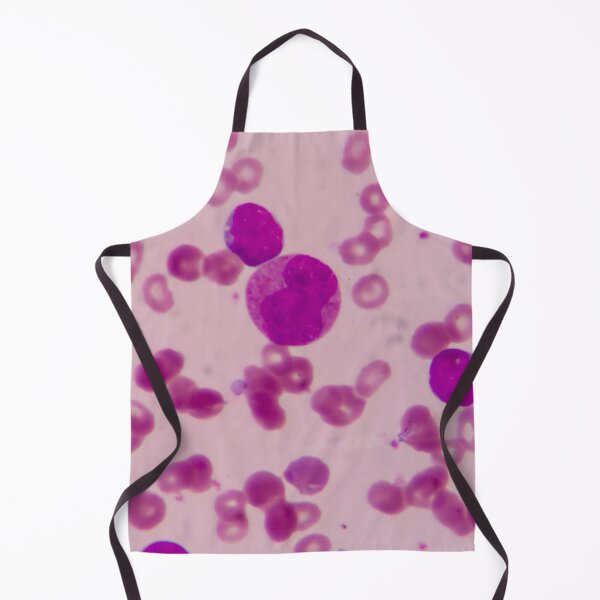 Item preview, BLAST CELLS BLOOD SMEAR MICROSCOPIC VIEW IMAGE MEDICAL LABORATORY SCIENTIST designed and sold by Hippiesole.
