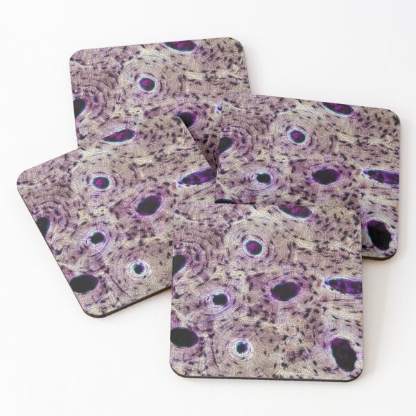 Item preview, Cross Section of Compact Bone designed and sold by ACH-Designs.