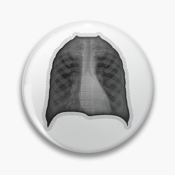 Item preview, X-ray designed and sold by RTSdesigns.