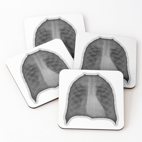 Item preview, X-ray designed and sold by RTSdesigns.