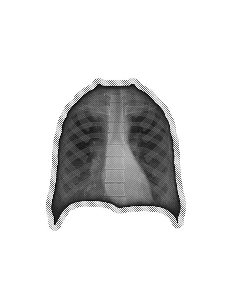 Thumbnail 4 of 4, iPhone Case, X-ray designed and sold by RTSdesigns.