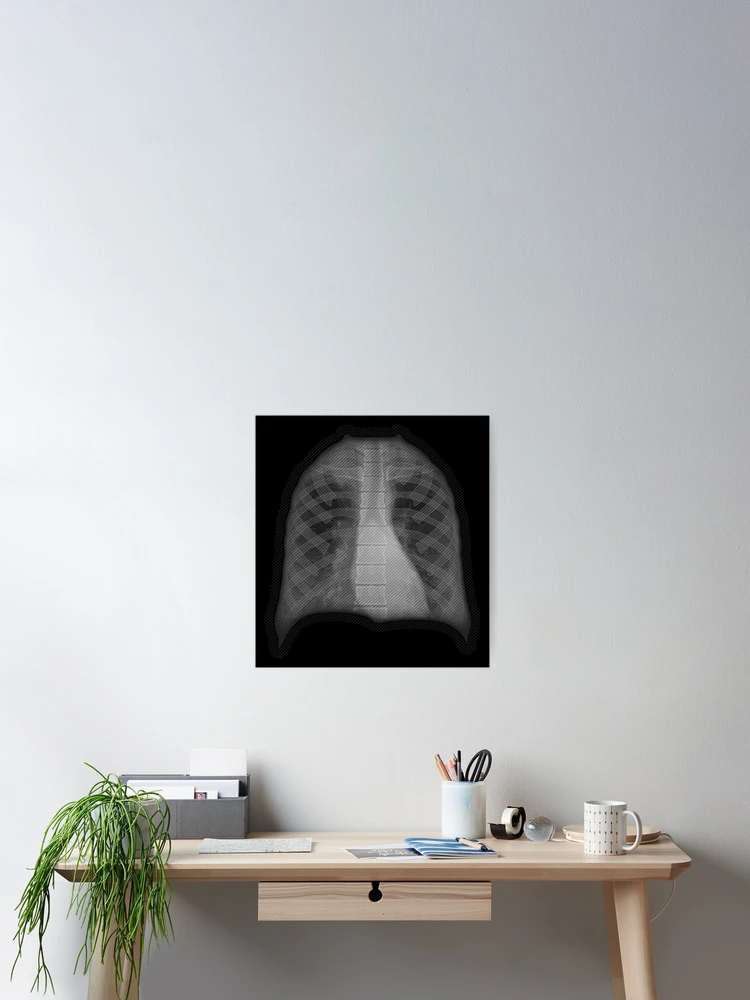 Thumbnail 2 of 3, Poster, X-ray designed and sold by RTSdesigns.