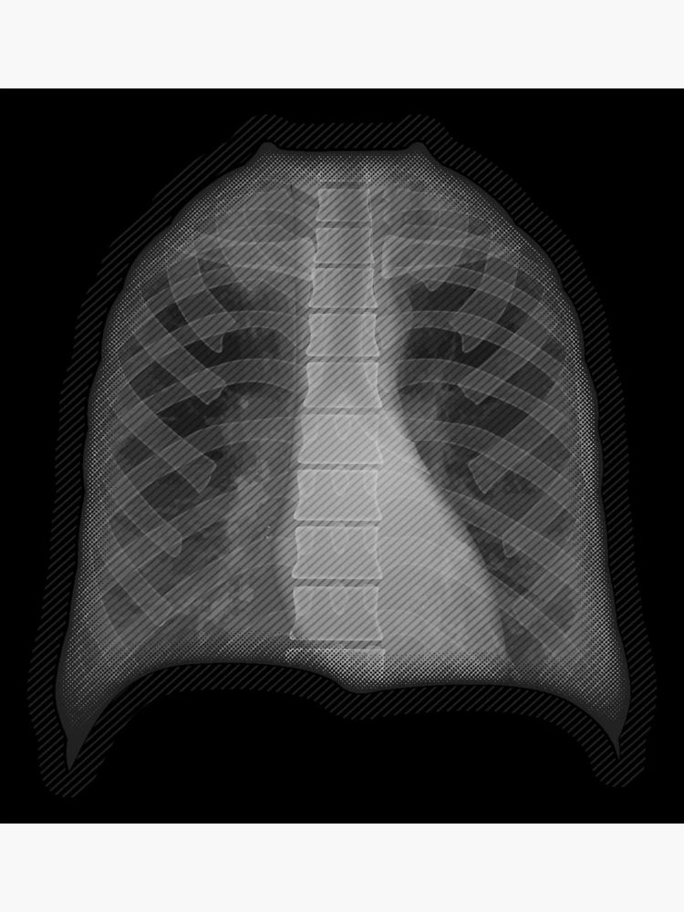 Thumbnail 3 of 3, Poster, X-ray designed and sold by RTSdesigns.