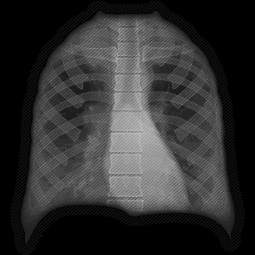Artwork thumbnail, X-ray by RTSdesigns