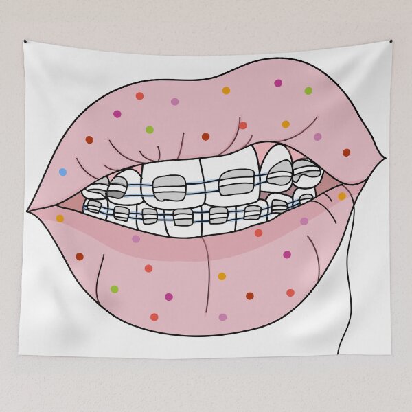 Item preview, Braceface designed and sold by ckai11.