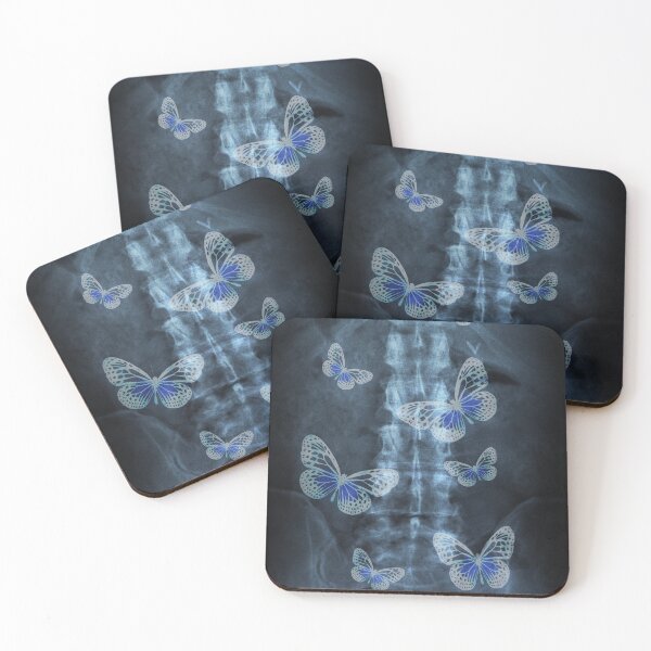 Item preview, Xray Butterfly designed and sold by Lhadii.