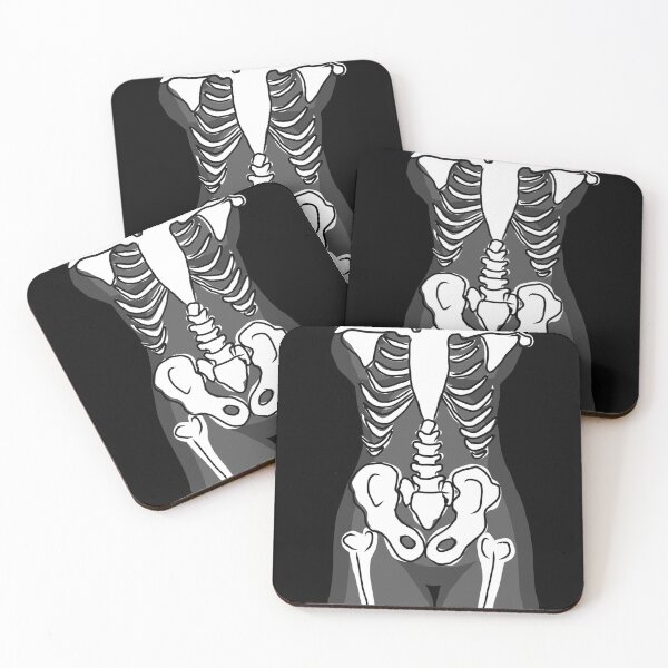 Item preview, Anorexia designed and sold by Saraelprints.