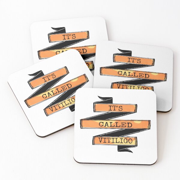 Item preview, It's called vitiligo  designed and sold by karimaK-71.
