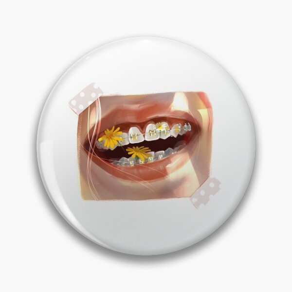 Item preview,  Girl with braces laughs in the sun. The braces are scattered with bright yellow flowers. designed and sold by MOSSSART.