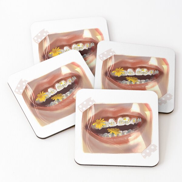 Item preview,  Girl with braces laughs in the sun. The braces are scattered with bright yellow flowers. designed and sold by MOSSSART.