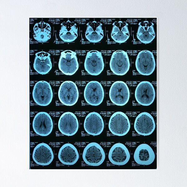 Item preview, MRI Human Brain designed and sold by Tarek-Tees.