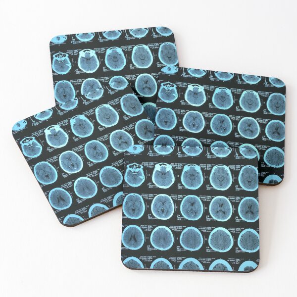Item preview, MRI Human Brain designed and sold by Tarek-Tees.