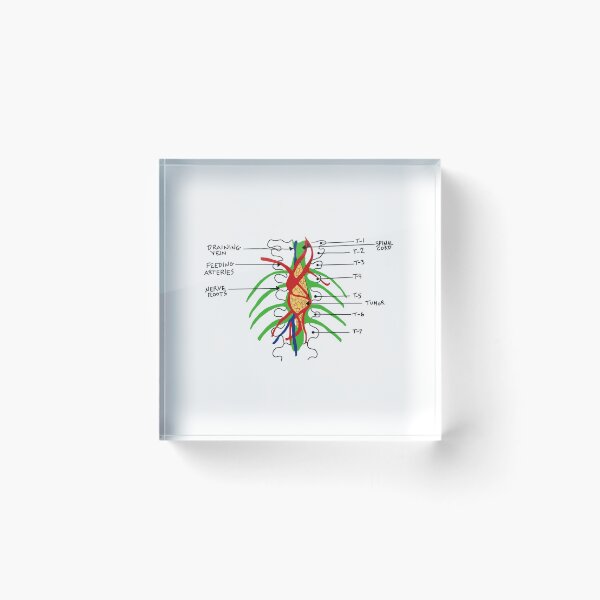 Item preview, Wall Tumor from Grey’s Anatomy. designed and sold by Raffy38Booboo.