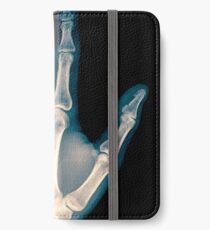 x-ray of wrist, hand and fingers iPhone Wallet/Case/Skin