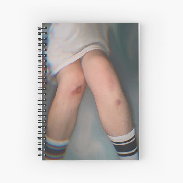 kneed something? Spiral Notebook