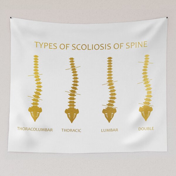 Item preview, Type of scoliosis of spine designed and sold by Liededrom..
