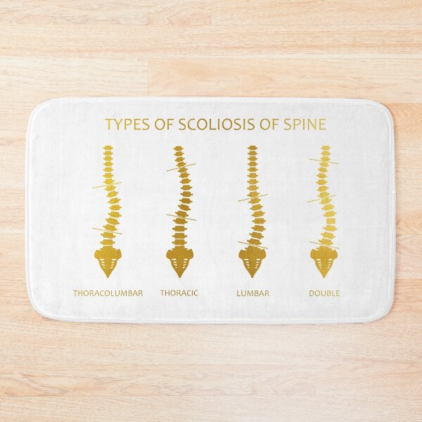 Item preview, Type of scoliosis of spine designed and sold by Liededrom..