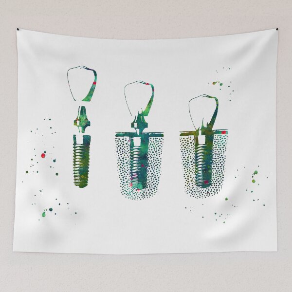 Item preview, Dental Implant Procedure designed and sold by EvasDreams.