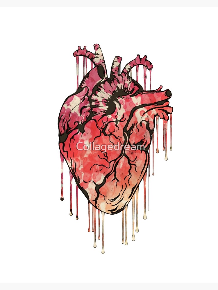 Human heart with stethoscope vector illustration outline sketch hand drawn  with black lines isolated on white background. | CanStock