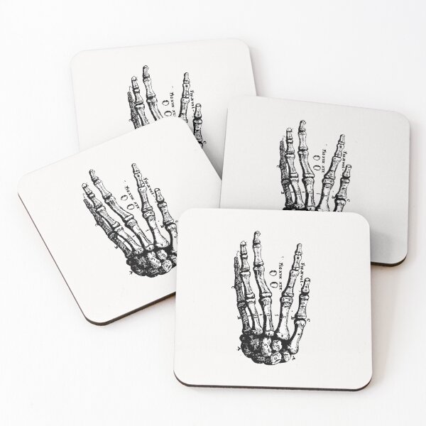 Item preview, Hand Skeleton Xray Sketch as radiography designed and sold by lodarohit.