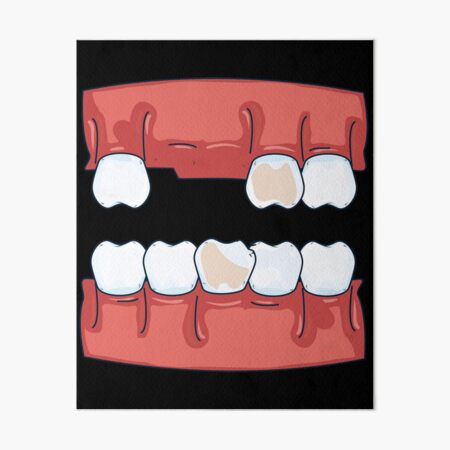 Funny Missing Teeth Wall Art | Redbubble