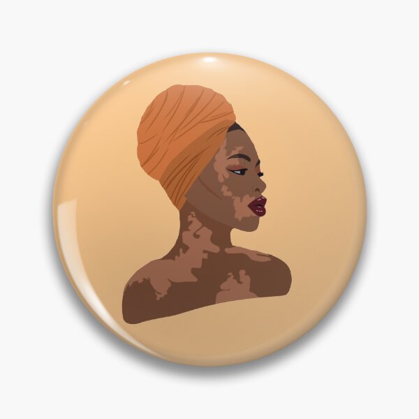 Item preview, Vitiligo Beauty designed and sold by haliemesko.