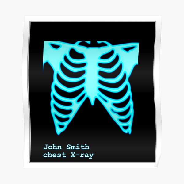 Funny X Ray Posters for Sale | Redbubble Funny X Ray Posters for Sale | Redbubble