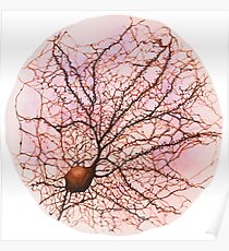 Dendritic tree and spines of an hippocampal neuron - watercolour - Pink Poster