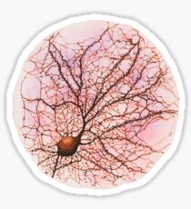 Dendritic tree and spines of an hippocampal neuron - watercolour - Pink Sticker
