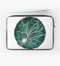 Dendritic tree and spines of an hippocampal neuron - Nebula Laptop Sleeve