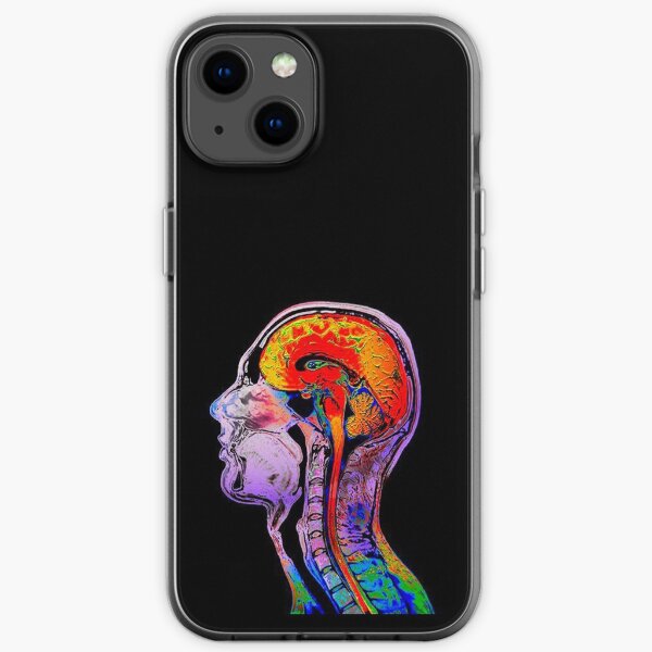 Human Anatomy Iphone Cases Redbubble