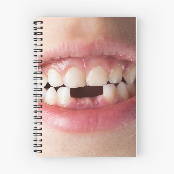 Item preview, Kiddie Gap Tooth Smile designed and sold by miTeless seDign.