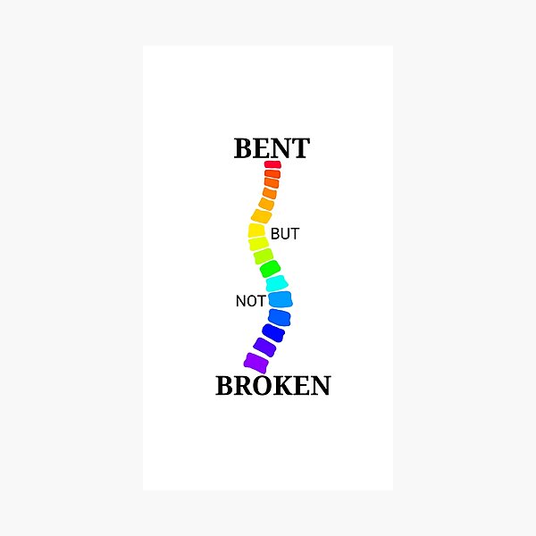 Scoliosis Bent but not Broken Photographic Print