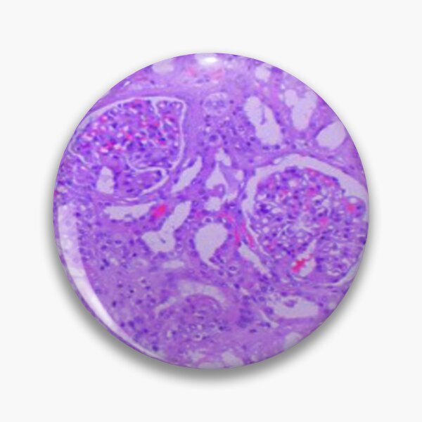 Item preview, Kidney tissue designed and sold by DarkiraVClemm.