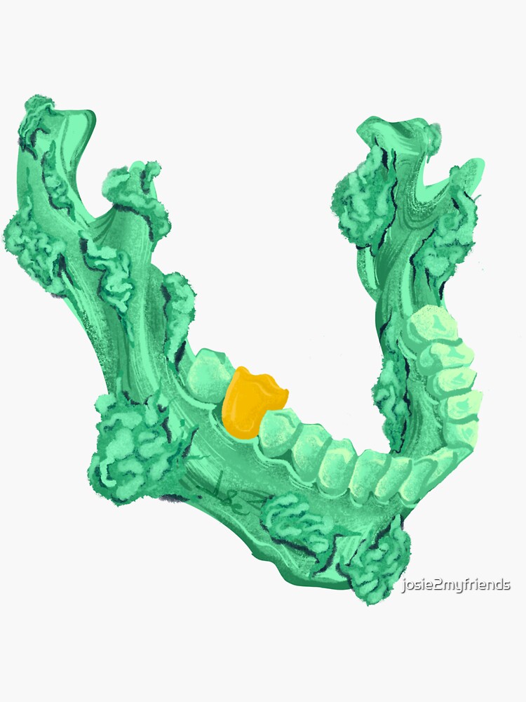 "Radium Jaw" Sticker by josie2myfriends Redbubble