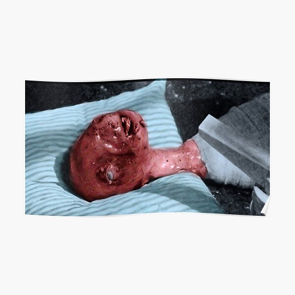 Eraserhead Baby Fan Art Poster