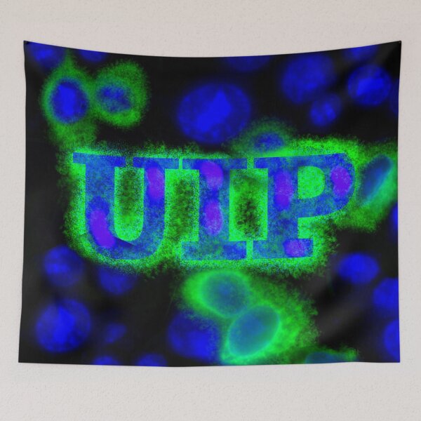 Item preview, UIP Florescent Antibody Tagging designed and sold by UISredbubble.