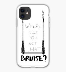 Where Did You Get That Bruise? iPhone Case
