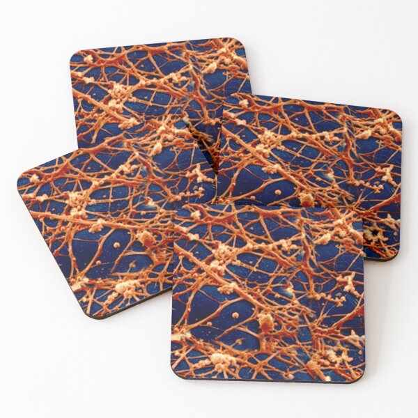 Item preview,  Neural filaments designed and sold by Galina Kostyaeva.