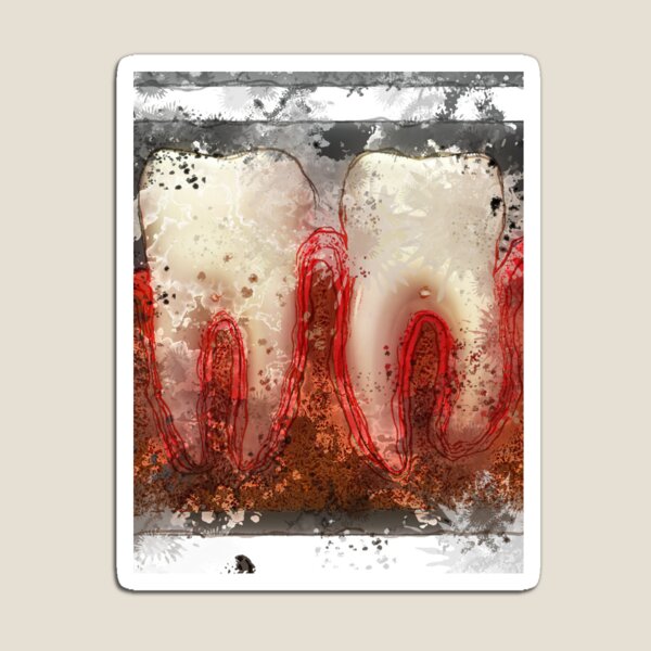 Item preview, Dental, dentist, theet, prosthesis 118 designed and sold by Dentalism.