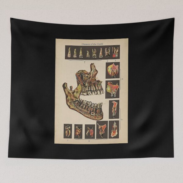 Item preview, Dentist Diseases Of The Teeth designed and sold by bethwagner44100.
