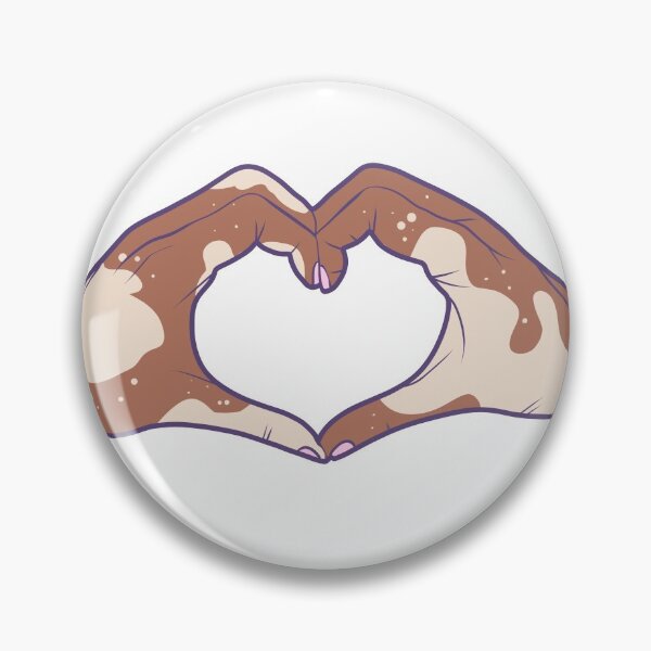 Item preview, Vitiligo Love designed and sold by illhustration.