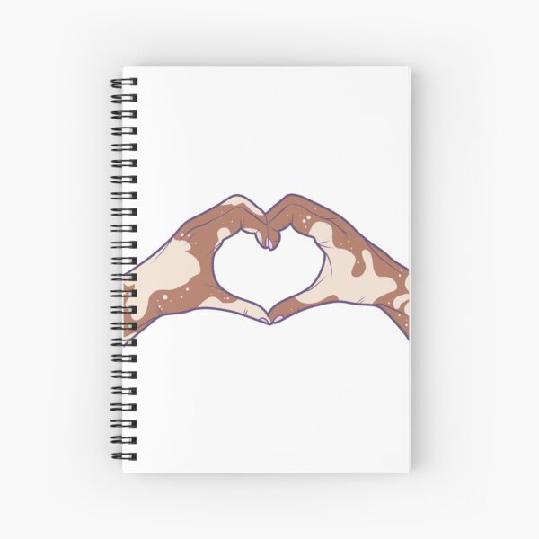 Aperçu de l'œuvre Amour Vitiligo créée et vendue par illhustration.