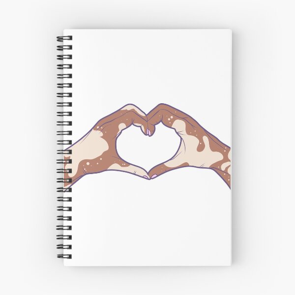Item preview, Vitiligo Love designed and sold by illhustration.